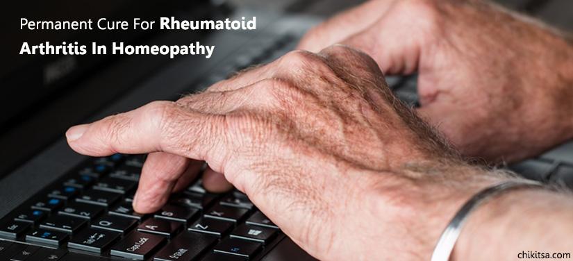 Permanent Cure for Rheumatoid Arthritis in Homeopathy