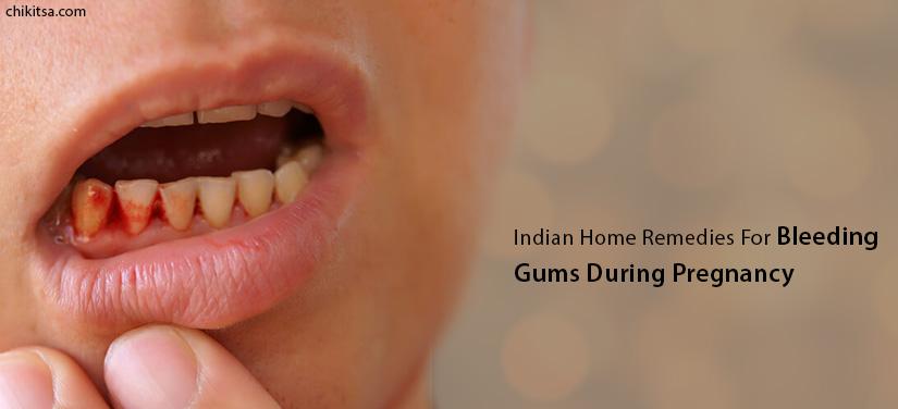 Indian home remedies for bleeding gums during pregnancy