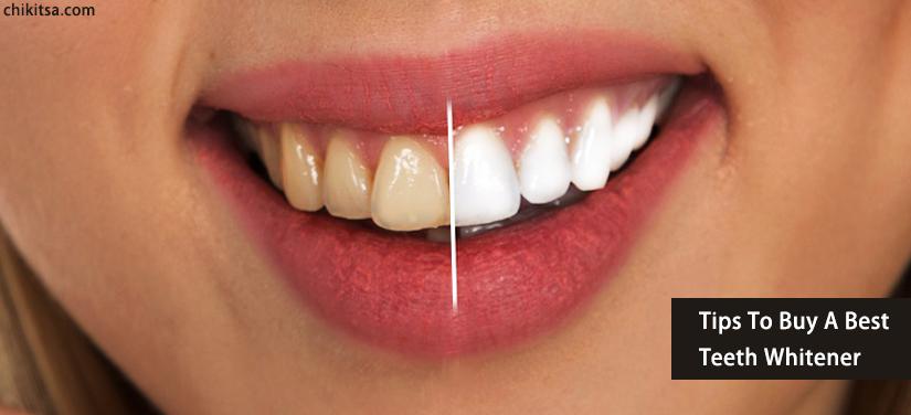 tips to buy a best teeth whitener