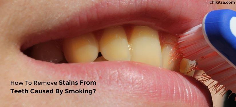 how to remove stains from teeth caused by smoking?