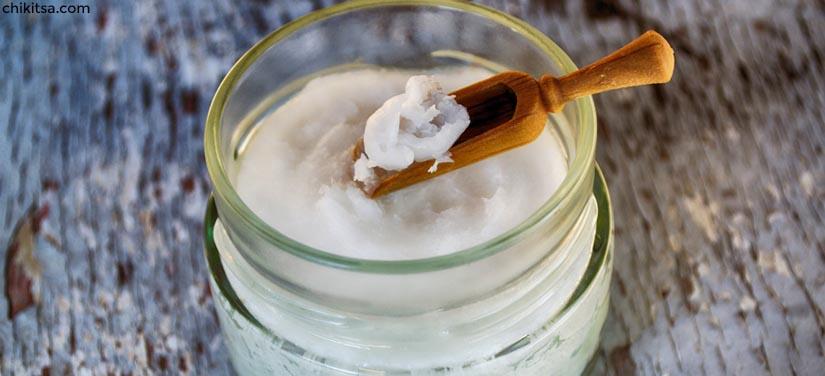 Coconut oil - Home remedy to remove stains from teeth caused by smoking