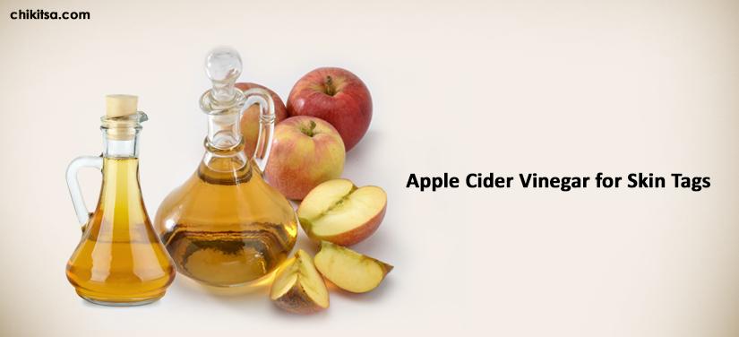 Apple Cider Vinegar For Skin Tags