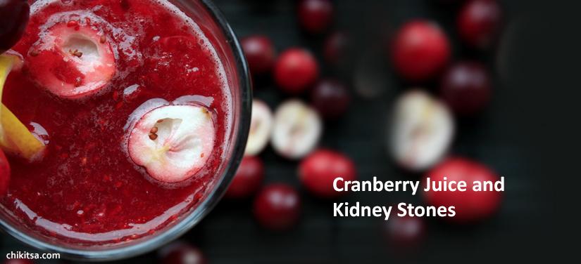 Cranberry Juice and Kidney Stones