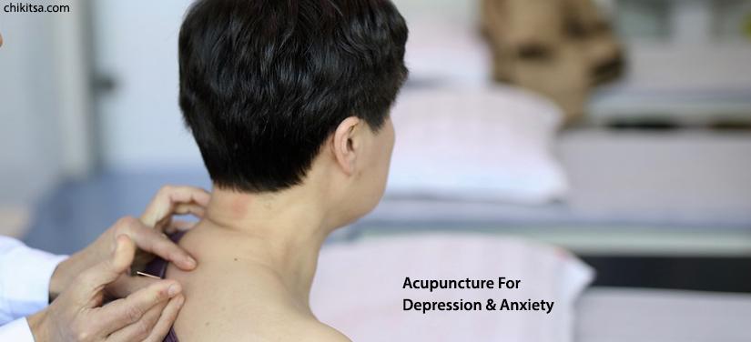 Acupuncture For Depression And Anxiety
