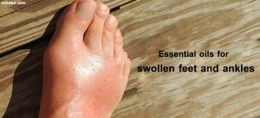 5 Essential Oils to Treat Swollen Feet & Ankles