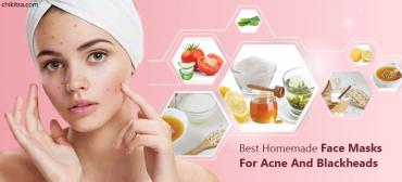 Homemade Face Masks To Treat Acne And Blackheads